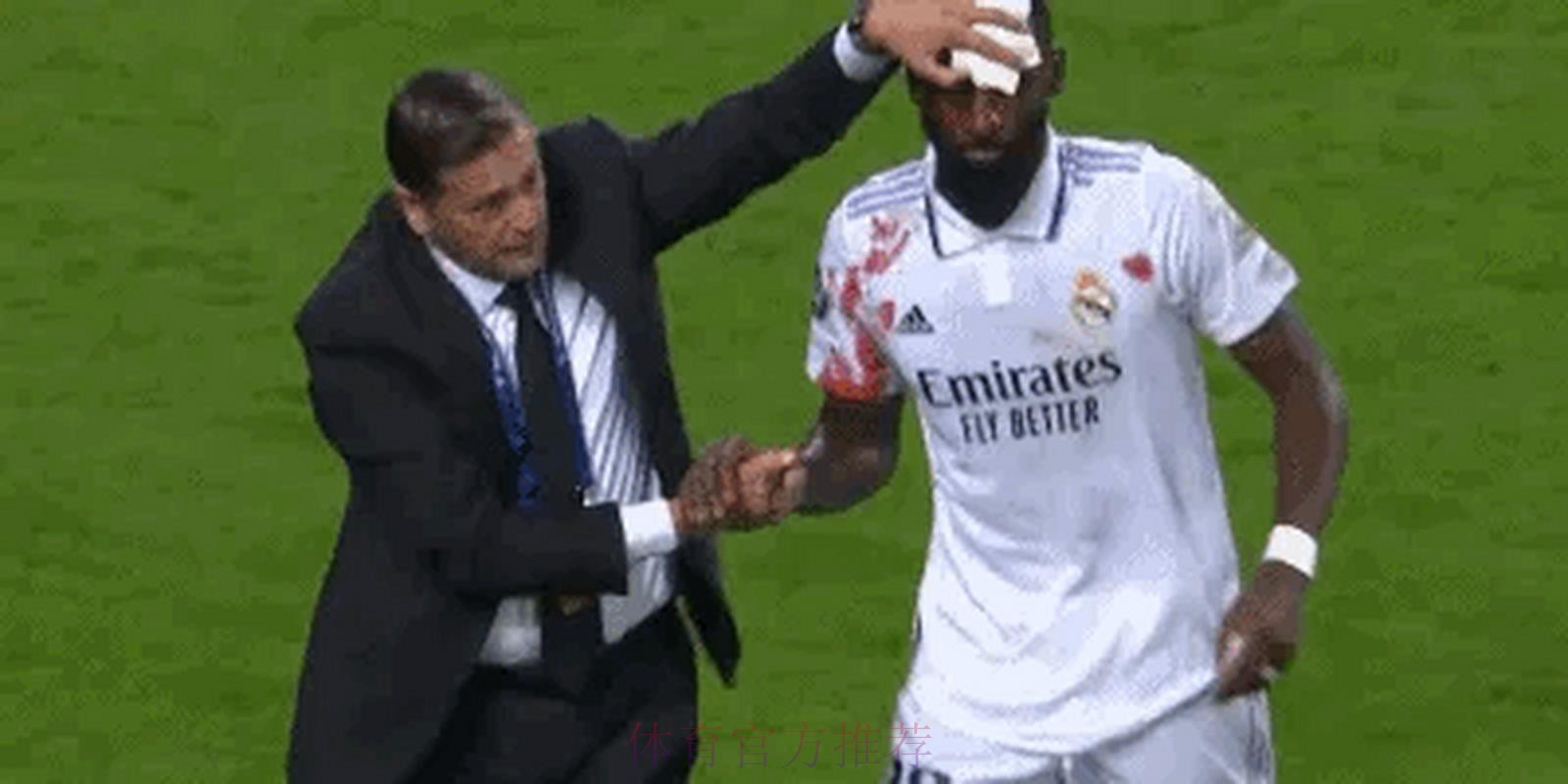 球衣全是血!皇马英雄95分钟舍身绝平 赛后缝20针 球衣全是血!皇马英雄95分钟舍身绝平 赛后缝20针